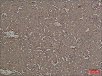 HIF-1α Rabbit pAb