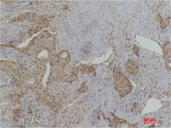 Histone H1(Phospho Thr17) Rabbit pAb