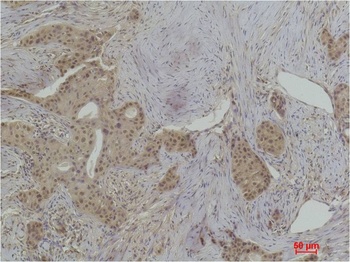 Histone H1 (phospho-Thr17) antibody