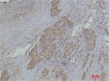 Histone H2A.X(Acetyl Lys5) Rabbit pAb