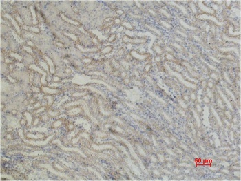 beta 1 Sodium Potassium ATPase Rabbit pAb Antibody