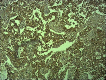 E-Cadherin Rabbit pAb