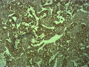 E-Cadherin antibody