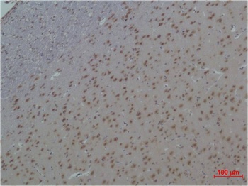 14-3-3 epsilon antibody