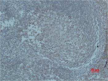 HIF-1 β/ARNT Rabbit pAb Antibody