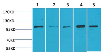 ERK5 Rabbit pAb Antibody