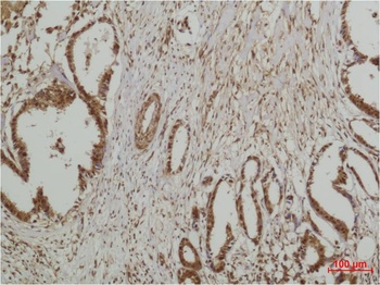 ERK5 Rabbit pAb Antibody