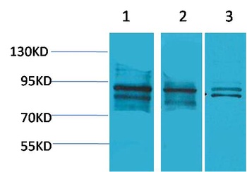 HIF-1β/ARNT Rabbit pAb Antibody