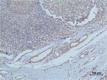 HIF-1β/ARNT Rabbit pAb Antibody