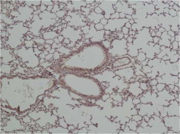 GSK 3β Rabbit pAb Antibody