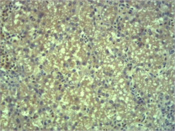 EPG5 antibody