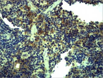 TLR1 Rabbit pAb Antibody