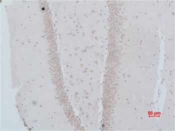 NMBR (Bombesin Receptor 1) Rabbit pAb