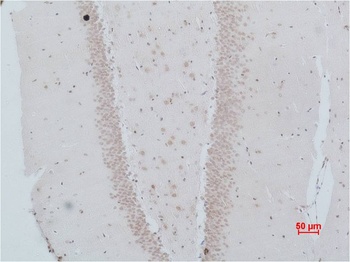 NMBR (Bombesin Receptor 1) antibody