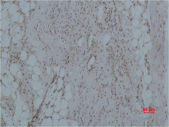 CALHM1 Rabbit pAb