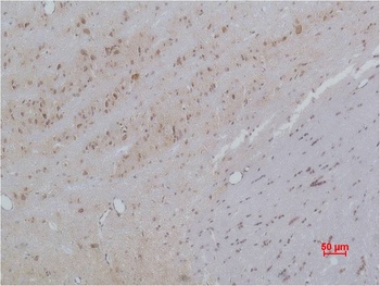 Cav β3 Rabbit pAb