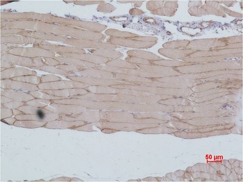 eEF1A2 binding protein Rabbit pAb