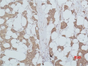 PI3 Kinase P85α Rabbit pAb Antibody