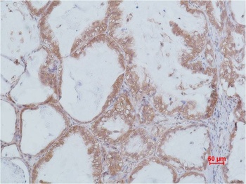 STAT2 Rabbit pAb