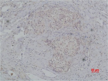 PI3 Kinase P85β Rabbit pAb Antibody