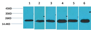 SOD2 Rabbit pAb Antibody