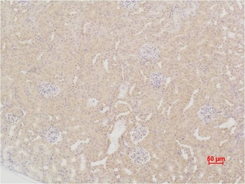 SOD2 Rabbit pAb Antibody