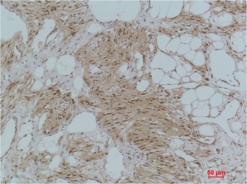 IκB α Rabbit pAb