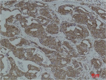 Calnexin Rabbit pAb Antibody