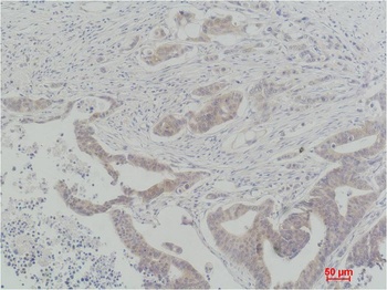 c-Raf Rabbit pAb Antibody