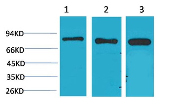 P70 S6 Kinase Rabbit pAb Antibody