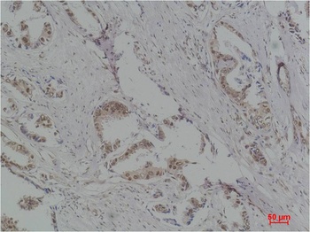 P70 S6 Kinase Rabbit pAb Antibody