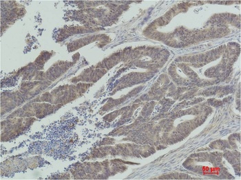 MEK1 antibody