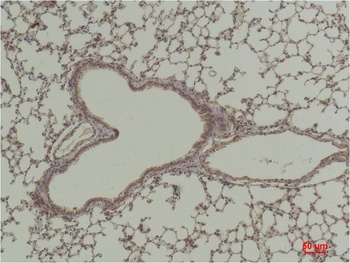 HAO1 antibody