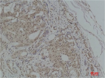 TGFβ1 Rabbit pAb