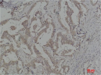 Caspase 8 Rabbit pAb