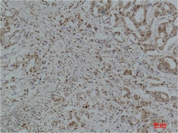GAPDH Rabbit pAb Antibody