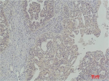 STAT5a Rabbit pAb