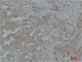 STAT3 Rabbit pAb Antibody