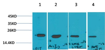 P21 Rabbit pAb Antibody