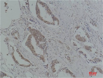 P21 Rabbit pAb Antibody