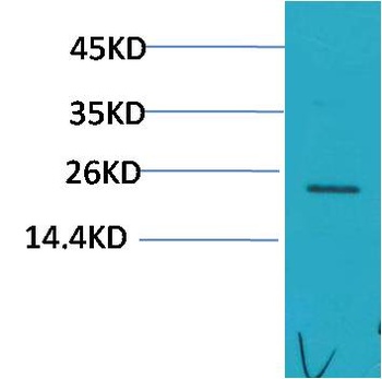 HSPB8/HSP22 Rabbit pAb Antibody