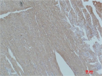 Smad2 Rabbit pAb Antibody