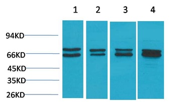 Estrogen Receptor α Rabbit pAb Antibody