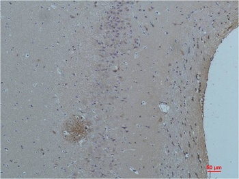 ASIC1 Rabbit pAb Antibody