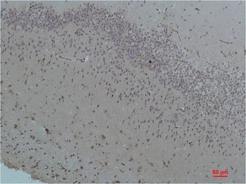 Bestrophin-1 Rabbit pAb