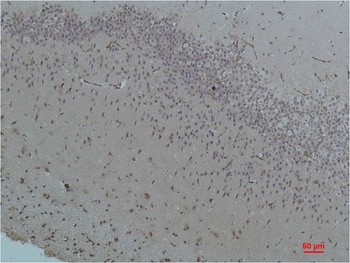 Bestrophin-1 antibody