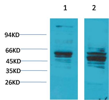 Bombesin Receptor 2 Rabbit pAb Antibody