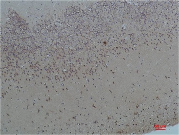 Bombesin Receptor 2 Rabbit pAb Antibody
