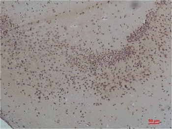 CaVα2δ1 Rabbit pAb