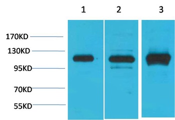 CaVα2δ2 Rabbit pAb Antibody